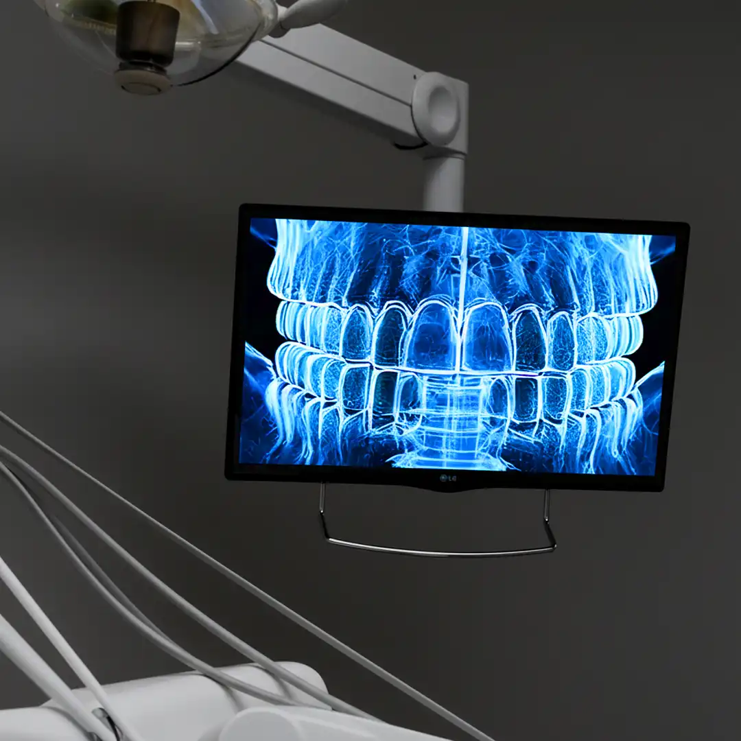 3D Print der DVT bei der Ansicht, so wie es in der Praxis üblich ist